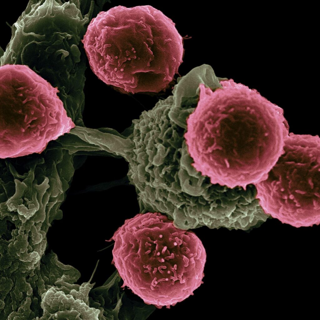 US Doctors Plan to Treat Cancer Patients Using CRISPR